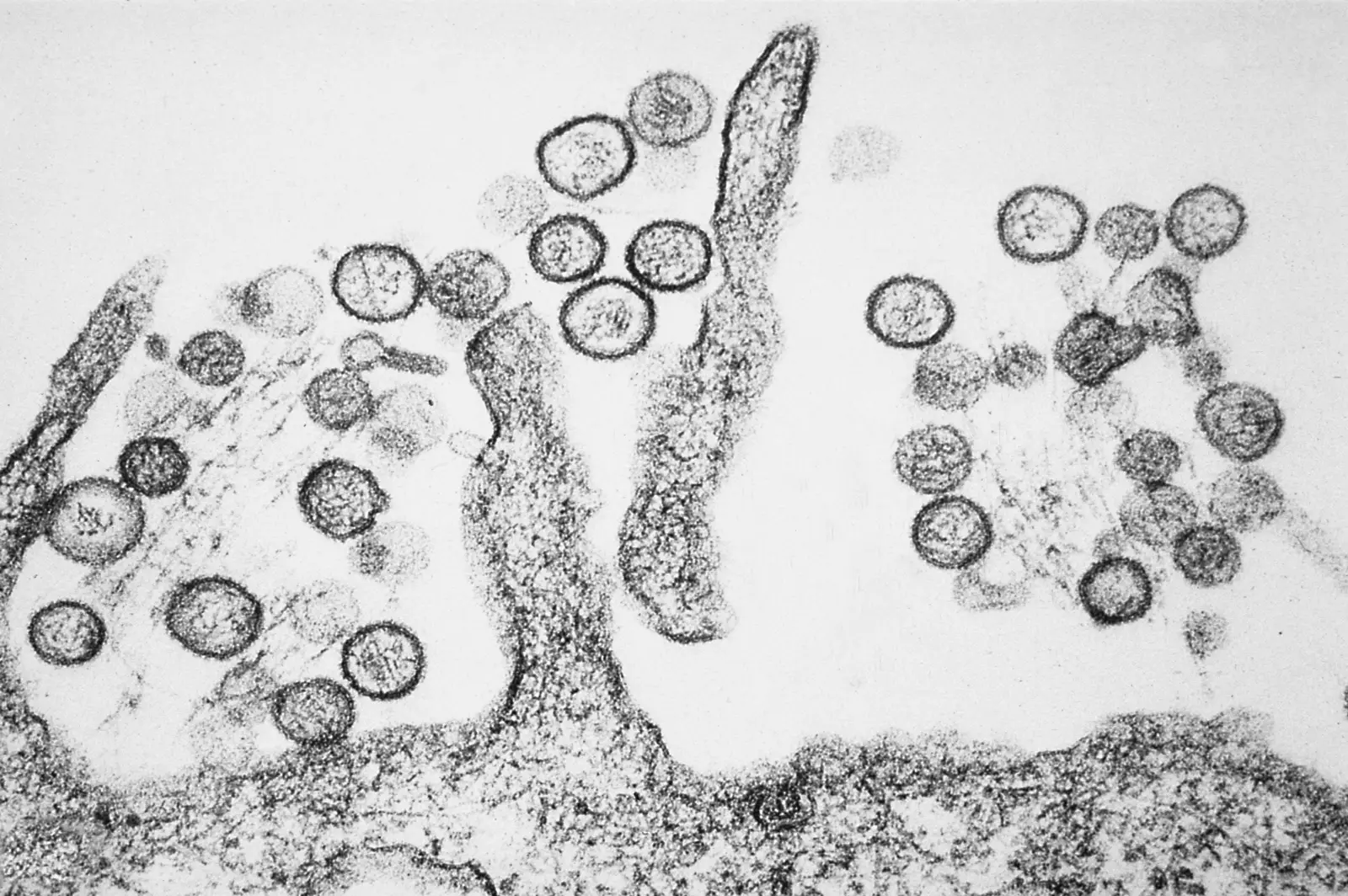 Microfotografía electrónica en blanco y negro: partículas esféricas de hantavirus, de contorno oscuro y granulado, brotando de la superficie de una célula.